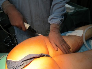 IMG_1244