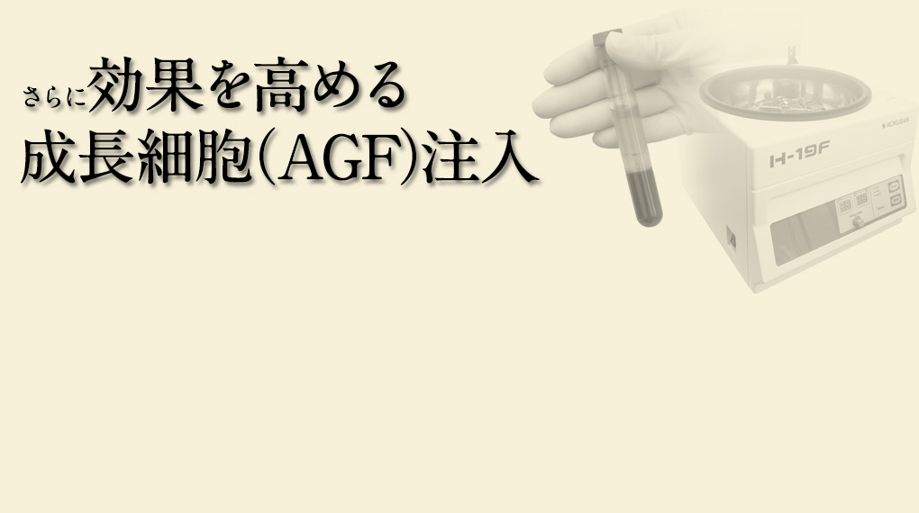 さらに効果を高める成長細胞(AGF)注入
