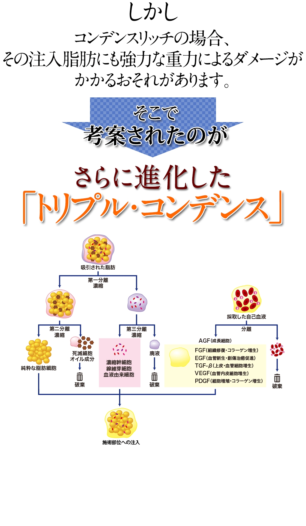 コンデンスリッチ
