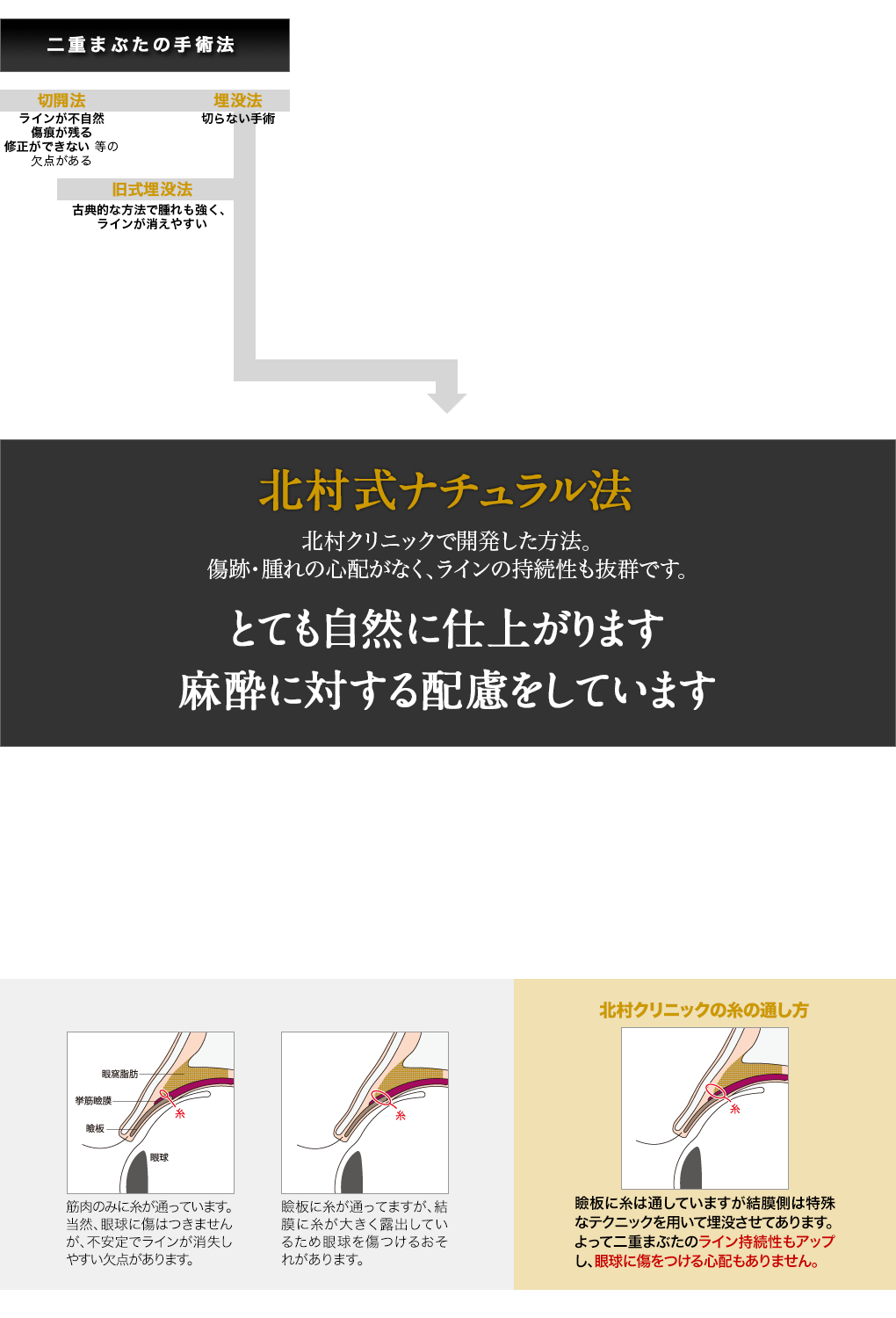 先天性眼瞼下垂と後天性眼瞼下垂