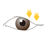 目頭形成/腫れぼったい目/目の上の凹み