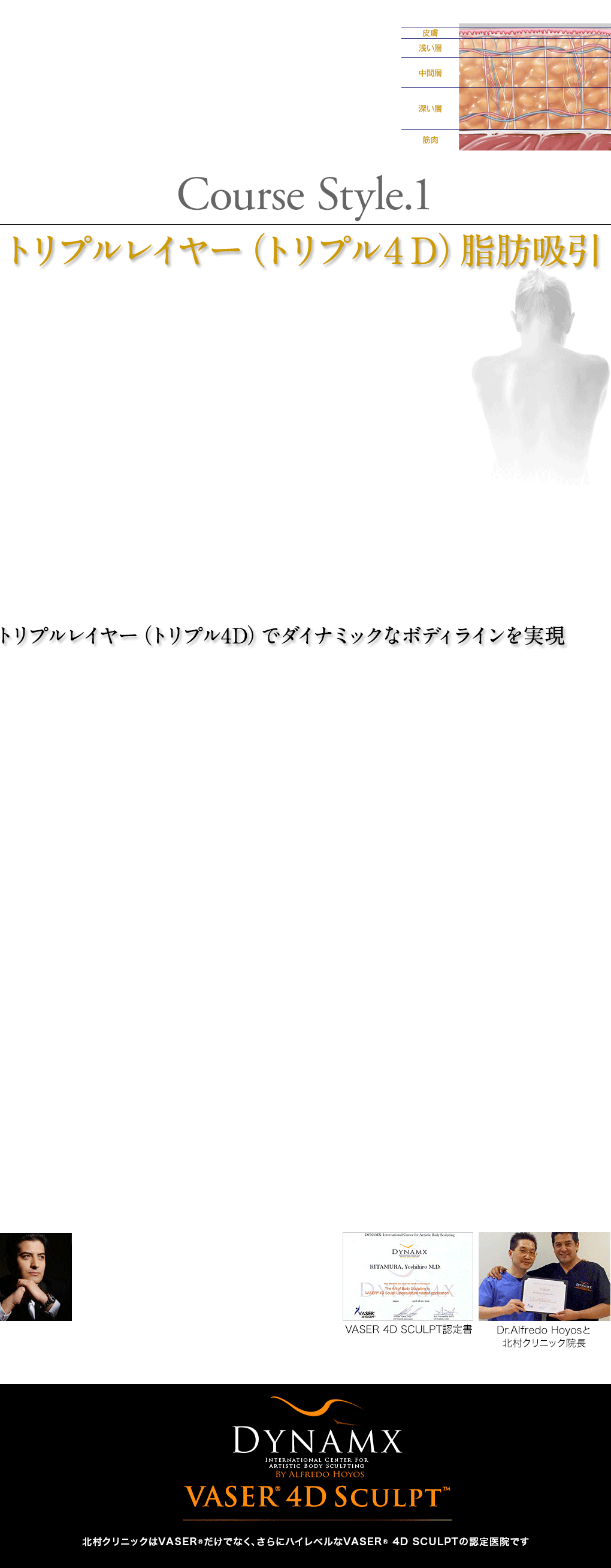 トリプルレイヤー(トリプル4D)脂肪吸引