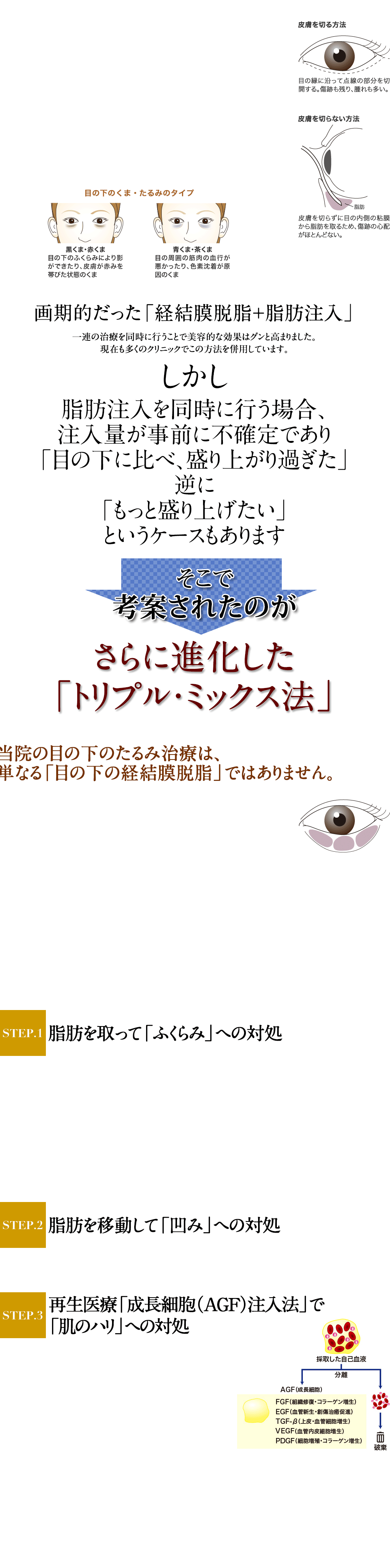 目の下のくま・たるみ治療