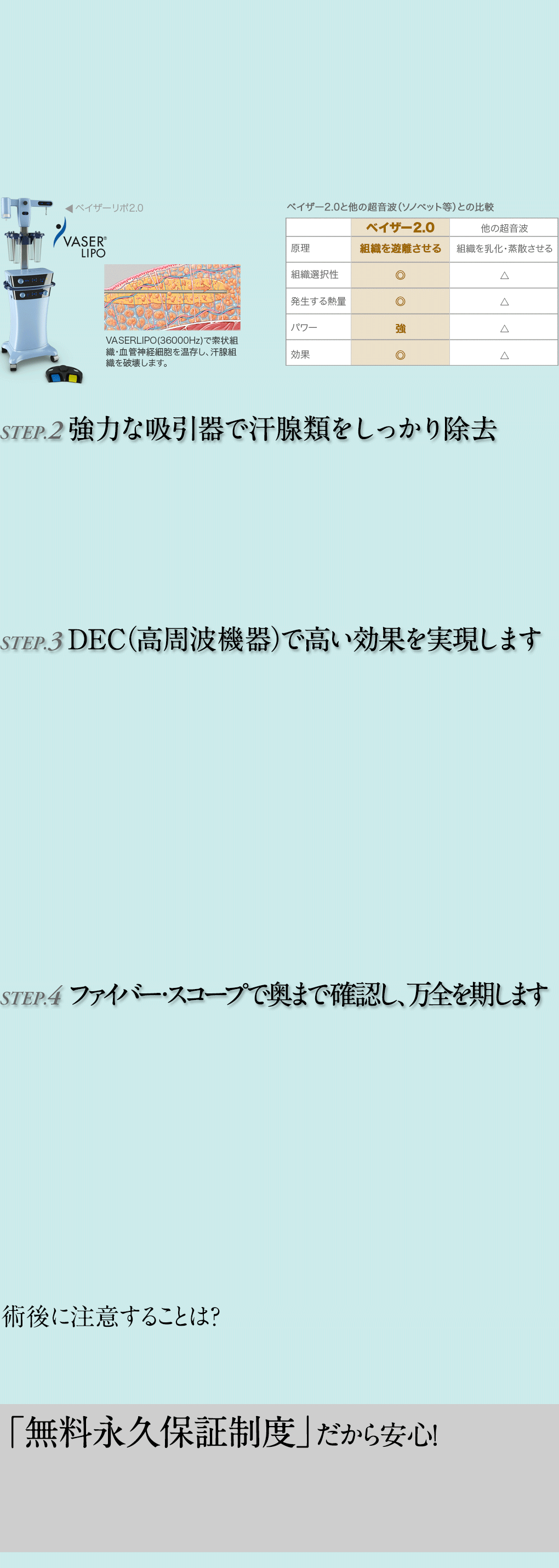 強力な吸引器で汗腺類をしっかり除去/DEC(高周波機器)で確実な効果を実現します/ファイバー・スコープで奥まで確認し、万全を期します