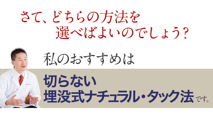 私のおすすめは切らない埋没式ナチュラル・タック法  です。