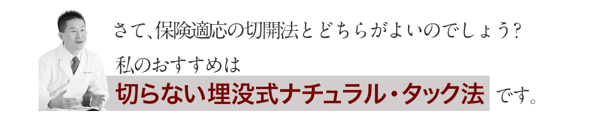 私のおすすめは切らない埋没式ナチュラル・タック法  です。